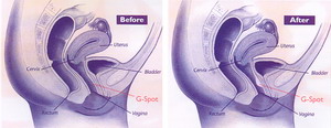 gspot2 gspot.jpg